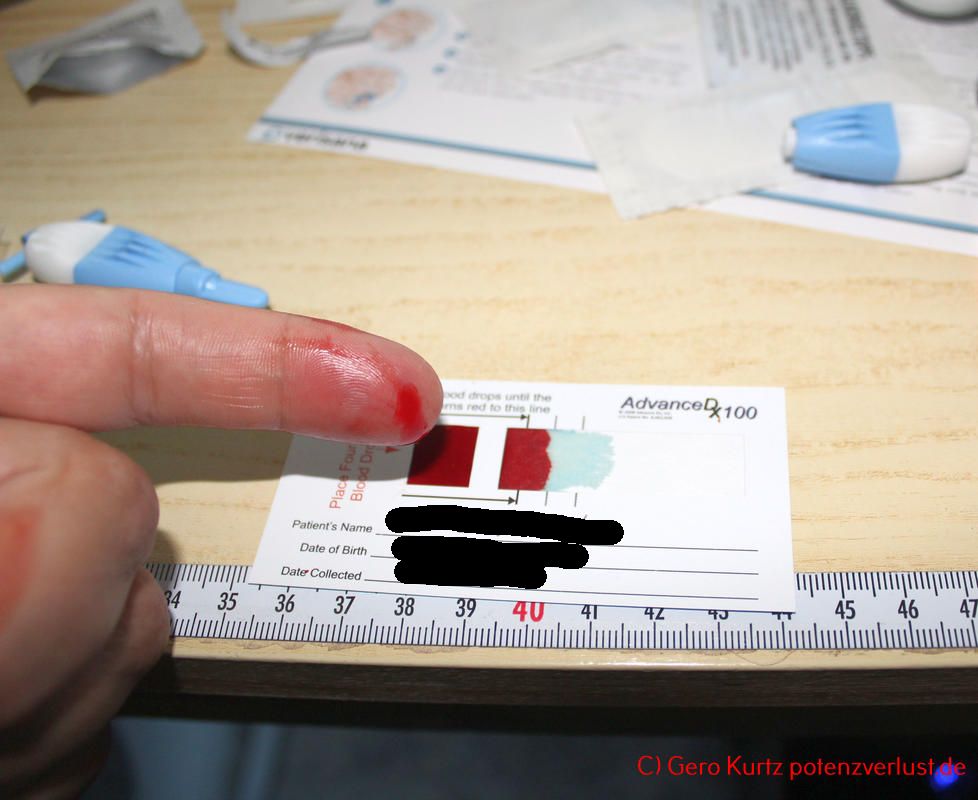 PSA-Test von Verisana - benutzte Blutkarte 