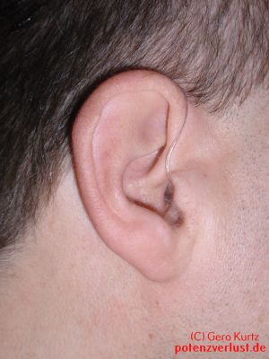 Ohr mit Hörgerät